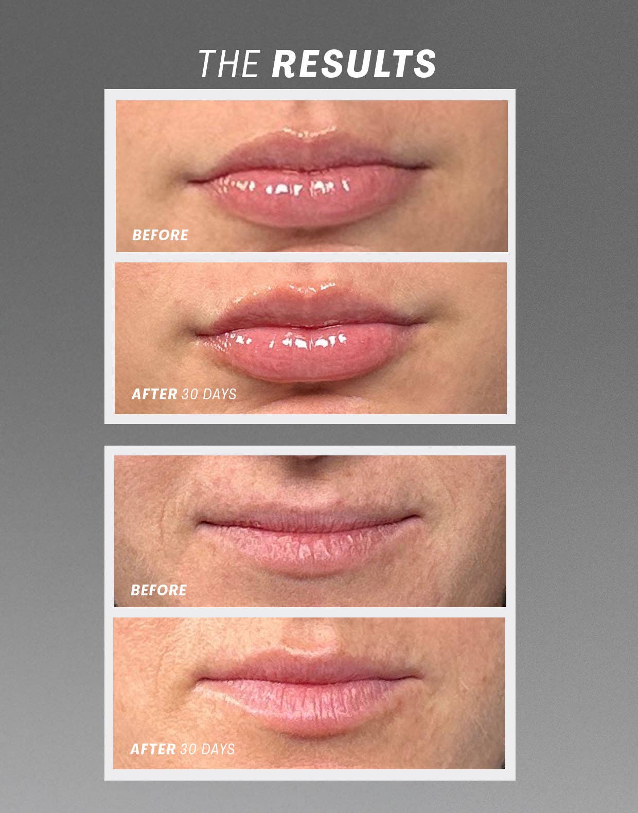 Lip Oasis Glossy Treatment - Clear